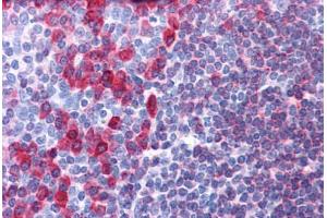 Human Tonsil: Formalin-Fixed, Paraffin-Embedded (FFPE) (CD79a Antikörper  (AA 202-216))