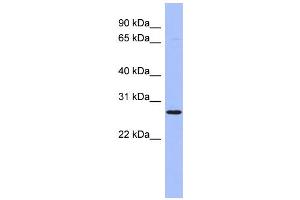 WB Suggested Anti-HOXA6 Antibody Titration:  0. (HOXA6 Antikörper  (Middle Region))