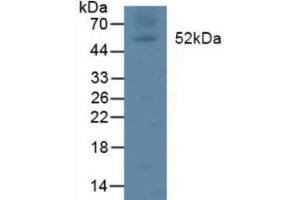 Detection of LPL in Rat Lymph Node Tissue using Polyclonal Antibody to Lipoprotein lipase (LPL) (Lipoprotein Lipase Antikörper  (AA 55-316))