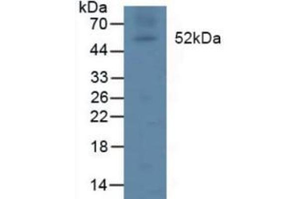 Lipoprotein Lipase Antikörper  (AA 55-316)