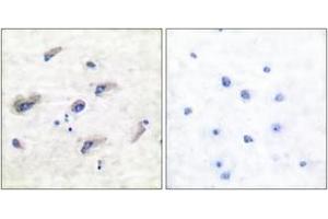 Immunohistochemistry analysis of paraffin-embedded human brain, using Tau (Phospho-Ser356) Antibody. (tau Antikörper  (pSer673))