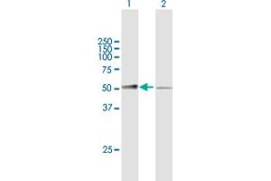 Western Blot analysis of MASP1 expression in transfected 293T cell line by MASP1 MaxPab polyclonal antibody. (MASP1 Antikörper  (AA 1-380))