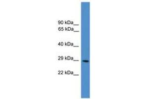 Image no. 1 for anti-Protein Kinase, CAMP Dependent, Catalytic, beta (PRKACB) (N-Term) antibody (ABIN6745502) (PRKACB Antikörper  (N-Term))