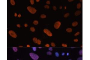 Immunofluorescence (IF) image for anti-Hepatoma-Derived Growth Factor (HDGF) antibody (ABIN7010580)
