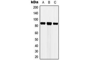 Western blot analysis of Cortactin expression in MCF7 (A), HeLa (B), NIH3T3 (C) whole cell lysates. (Cortactin Antikörper  (Center))