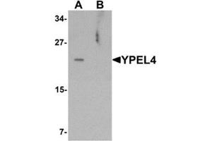 Western blot analysis of YPEL4 in SW480 cell lysate with YPEL4 antibody at 1 ug/mL in (A) the absence and (B) the presence of blocking peptide. (YPEL4 Antikörper  (N-Term))