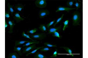 Immunofluorescence of monoclonal antibody to HN1L on HeLa cell.