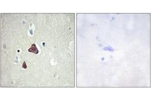 Immunohistochemistry (IHC) image for anti-Adenylate Cyclase 8 (Brain) (ADCY8) (AA 591-640) antibody (ABIN2889854) (ADCY8 Antikörper  (AA 591-640))