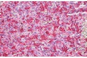 Immunohistochemistry (IHC) image for anti-Heme Oxygenase (Decycling) 1 (HMOX1) (AA 1-30) antibody (ABIN1804297)