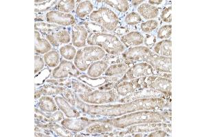 Immunohistochemistry of paraffin-embedded mouse kidney using SNRPD1 Rabbit pAb (ABIN7270363) at dilution of 1:50 (40x lens).