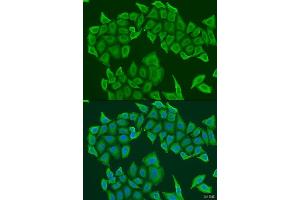 Immunofluorescence analysis of U2OS cells using HAUS8 antibody. (NYS48/HAUS8 Antikörper  (AA 166-410))