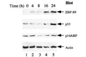 Image no. 2 for anti-Zinc Finger Protein 148 (ZNF148) antibody (ABIN299225) (ZNF148 Antikörper)