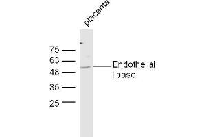 Mouse placenta lysates probed with Anti-Endothelial lipase Polyclonal Antibody, Unconjugated  at 1:5000 90min in 37˚C. (LIPG Antikörper  (AA 301-400))