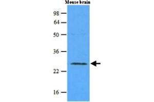 Western blot analysis of mouse brain extracts (45 ug) were resolved by SDS - PAGE , transferred to NC membrane and probed with RAB5A monoclonal antibody , clone 3A4 (1 : 500) .