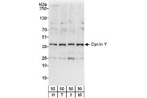anti-Cyclin Y (CCNY) (AA 291-341) antibody