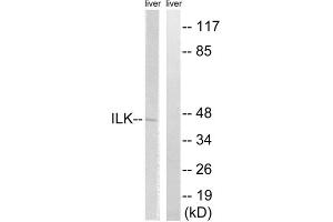 Western blot analysis of extracts from rat liver cells, using ILK (epitope around residue 246) antibody. (ILK Antikörper  (Ser246))
