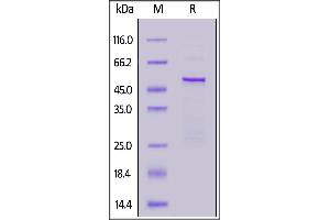 HCoV-229E Nucleocapsid Protein (HCoV-229E NP) (AA 1-389) protein (His tag)