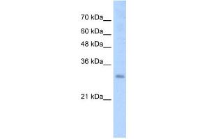 WB Suggested Anti-SOX15 Antibody Titration:  2. (SOX15 Antikörper  (N-Term))