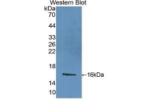 Detection of Recombinant LIMCH1, Mouse using Polyclonal Antibody to LIM And Calponin Homology Domains Containing Protein 1 (LIMCH1) (LIMCH1 Antikörper  (AA 21-125))