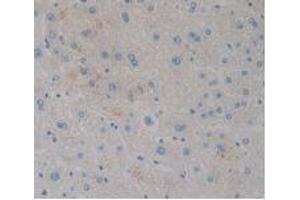IHC-P analysis of Human Liver Tissue, with DAB staining. (CCK8 Antikörper)