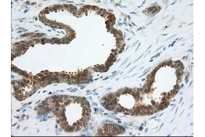 Immunohistochemical staining of paraffin-embedded Human Kidney tissue using anti-ACAT2 mouse monoclonal antibody. (ACAT2 Antikörper)