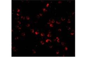 Immunofluorescence of ARF-BP1 in Daudi cells with AP30078PU-N ARF-BP1 antibody at 20 μg/ml. (HUWE1 Antikörper  (C-Term))