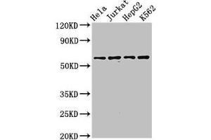 Western Blot Positive WB detected in: Hela whole cell lysate, Jurkat whole cell lysate, HepG2 whole cell lysate, K562 whole cell lysate All lanes: SMARCD1 antibody at 3.