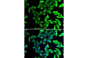 Immunofluorescence analysis of U2OS cells using VSNL1 antibody.
