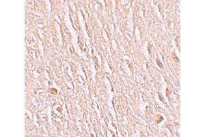Immunohistochemistry (IHC) image for anti-Leucine Rich Repeat Transmembrane Neuronal 3 (LRRTM3) (C-Term) antibody (ABIN1030498) (LRRTM3 Antikörper  (C-Term))