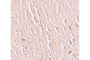Immunohistochemistry (IHC) image for anti-Leucine Rich Repeat Transmembrane Neuronal 3 (LRRTM3) (C-Term) antibody (ABIN1030498)