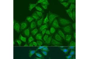 Immunofluorescence analysis of U2OS cells using PLOD1 Polyclonal Antibody at dilution of 1:100. (PLOD1 Antikörper)