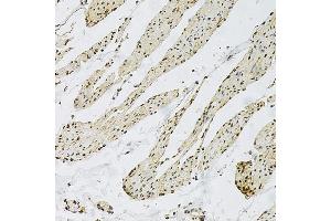Immunohistochemistry of paraffin-embedded human smooth muscle using CD9 Rabbit pAb  at dilution of 1:100 (40x lens). (CD9 Antikörper  (AA 112-195))