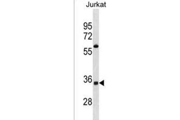 OR52A5 Antikörper  (C-Term)