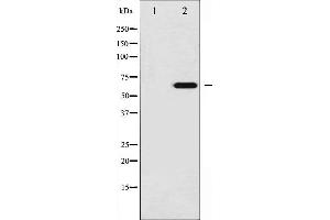 Western blot analysis of Ezrin phosphorylation expression in UV treated 293 whole cell lysates,The lane on the left is treated with the antigen-specific peptide. (Ezrin Antikörper  (pTyr146))