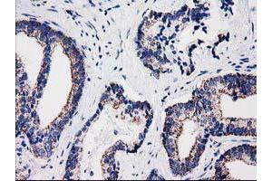 Image no. 1 for anti-Sulfotransferase Family, Cytosolic, 1A, Phenol-Preferring, Member 1 (SULT1A1) antibody (ABIN1501226) (SULT1A1 Antikörper)