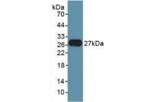 Detection of Recombinant FGF21, Rat using Polyclonal Antibody to Fibroblast Growth Factor 21 (FGF21) (FGF21 Antikörper  (AA 25-208))