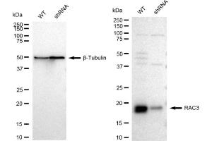 Western blotting analysis using RAC3 antibody (ABIN7800145).
