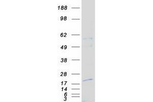 Validation with Western Blot