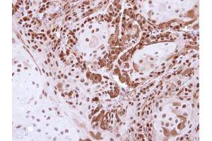IHC-P Image Immunohistochemical analysis of paraffin-embedded Cal27 Xenograft , using DDB1, antibody at 1:500 dilution.