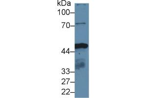 Detection of IDH1 in Human HepG2 cell lysate using Polyclonal Antibody to Isocitrate Dehydrogenase 1, Soluble (IDH1) (IDH1 Antikörper  (AA 74-333))