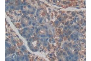 Detection of EPCR in Rat Pancreas Tissue using Polyclonal Antibody to Endothelial protein C receptor (EPCR) (PROCR Antikörper  (AA 59-217))