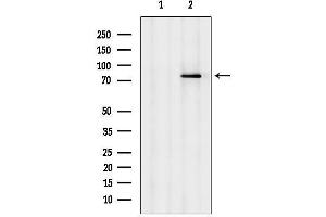 anti-DEXH (Asp-Glu-X-His) Box Polypeptide 58 (DHX58) (Internal Region) antibody
