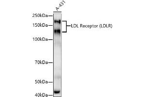 Western blot analysis of extracts of A-431 cells, using LDL Receptor (LDLR) antibody  at 1:1000 dilution. (LDLR Antikörper)