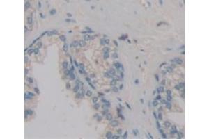 IHC-P analysis of Kidney tissue, with DAB staining. (POTEG Antikörper  (AA 177-330))
