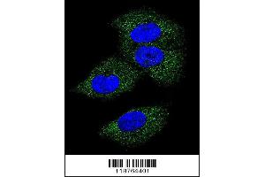 Confocal immunofluorescent analysis of M-CSF Antibody with MDA-MB231 cell followed by Alexa Fluor 488-conjugated goat anti-rabbit lgG (green). (M-CSF/CSF1 Antikörper  (AA 230-257))