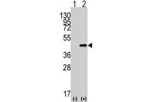 Western blot analysis of CDX2 (arrow) using rabbit CDX2 polyclonal antibody  . (CDX2 Antikörper  (N-Term))