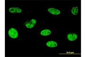 Immunofluorescence of monoclonal antibody to HOXA5 on HeLa cell. (HOXA5 Antikörper  (AA 171-270))