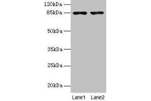 Western blot All lanes: FCHSD2 antibody at 12 μg/mL Lane 1: U251 whole cell lysate Lane 2: A549 whole cell lysate Secondary Goat polyclonal to rabbit IgG at 1/10000 dilution Predicted band size: 85, 78, 59 kDa Observed band size: 85 kDa (FCHSD2 Antikörper  (AA 1-290))