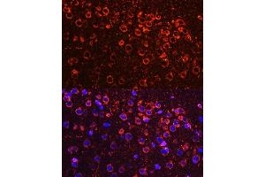Immunofluorescence analysis of mouse brain using YB-1/YB-1/YBX1 antibody (ABIN6134494, ABIN6150328, ABIN6150330 and ABIN7101815) at dilution of 1:100. (YBX1 Antikörper  (AA 100-200))