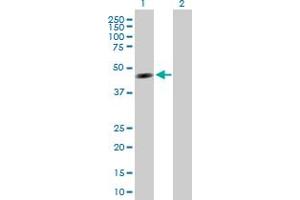 Western Blot analysis of TTRAP expression in transfected 293T cell line by TTRAP MaxPab polyclonal antibody. (TDP2 Antikörper  (AA 1-362))